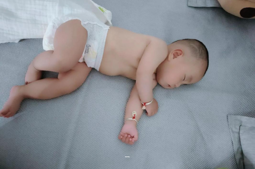 郓城宝宝脸上有白色斑块